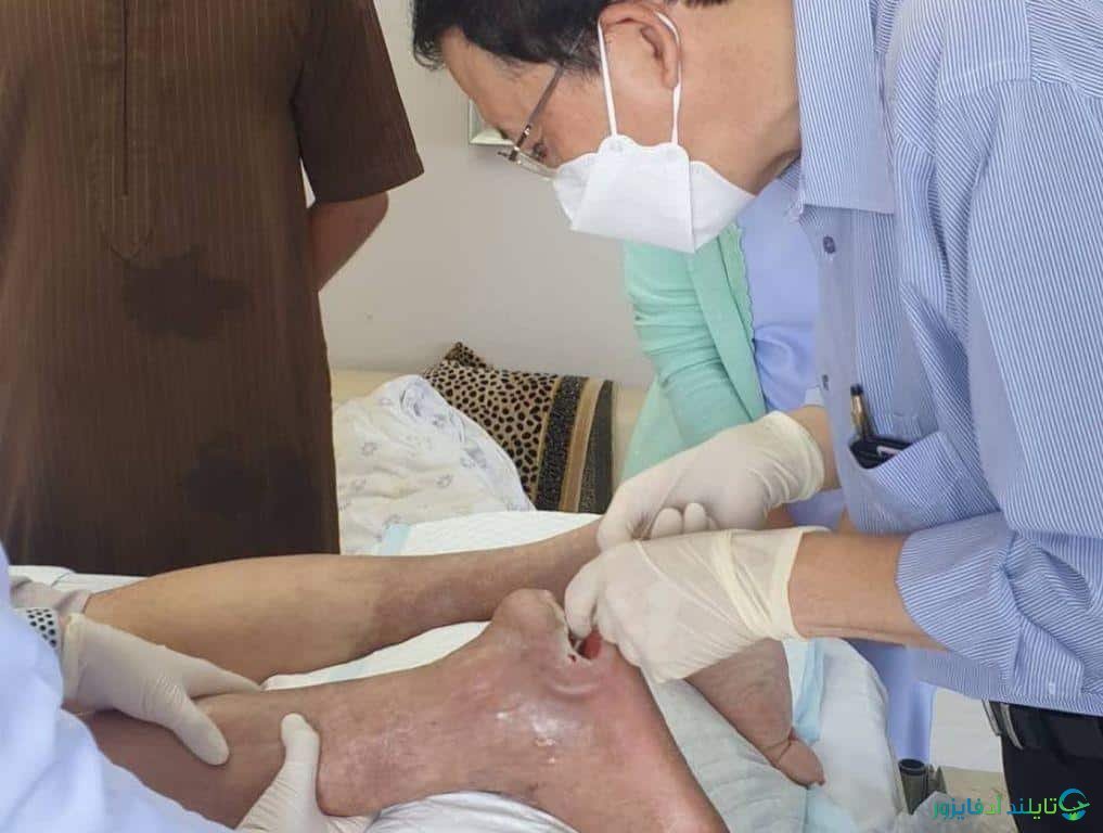 افضل مستشفيات الأوعية الدموية الطرفية 2025 وعلاج القدم السكري في تايلاند